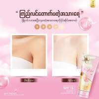 Lotion ဝယ္ပီး ေနာင္တမရခ်င္ဖူးဆိုရင္ Skin Perfect ကိုေရြး ???

Super Hydrating မို့ အသားရည္ကို ေရဓာတ္အျပည့္ဝေပးပုံက ခမ္းေျခာက္ေနတဲ့ ေရငတ္ညႇိုးႏြမ္းေနတဲ့ အသားရည္ကို ေရေလာင္းခ်လိုက္သလိုပါဘဲ ?

လိမ္းလိုက္ရင္ ေအးေအးေလးနဲ႔ အနံ့ကစေအးခ်မ္းပီးလန္းဆန္း fresh ျဖ