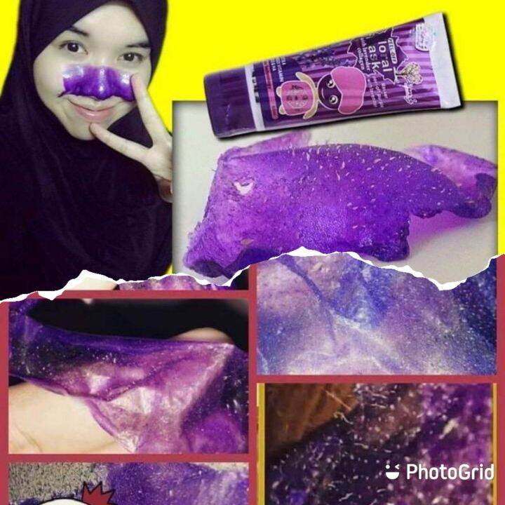 Flora Mask Hilangkan Blackhead dan Whitehead( sales) Lazada