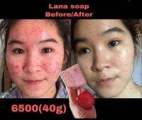 Lana soap