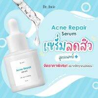 ลดราคา! เซรั่มสิว คอลล่าแอค (หมดอายุ 11/10/23) 20 ml. เซรั่มปัญหาสิว รอยสิว คุมมัน