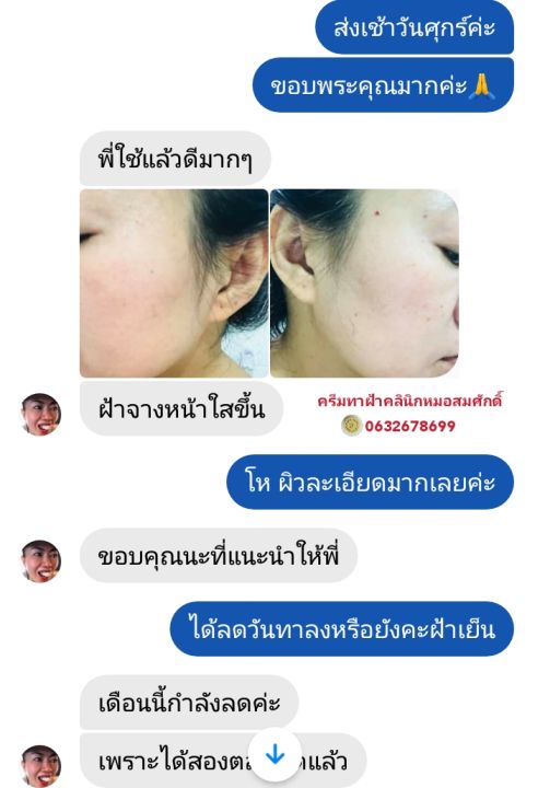 ส่งฟรี-คู่ครีมรักษาฝ้า-หน้าเงาใส-คลินิกหมอสมศักดิ์-นายแพทย์สมศักดิ์-คุณจักร