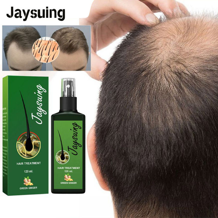 Jaysuing Green Ginger Hair Growth Spray Serum Natural Anti Hair Loss  Products Fast Growing Treatments Germinal Liquid For Men Women | Lazada