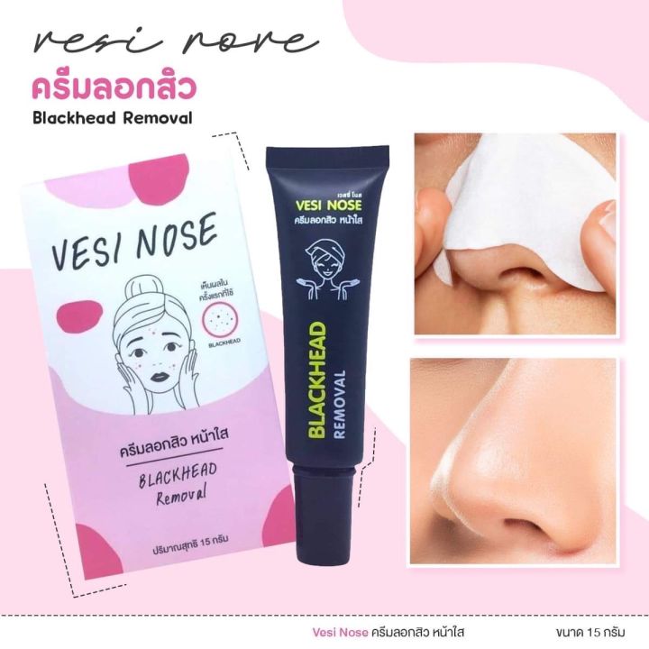 vesi-nose-ครีมลอกสิวเวสซีโนส-แค่แปะผิวก็เนียน-สิวเสี้ยน-สิวหัวดำ-สิวอุดตัน