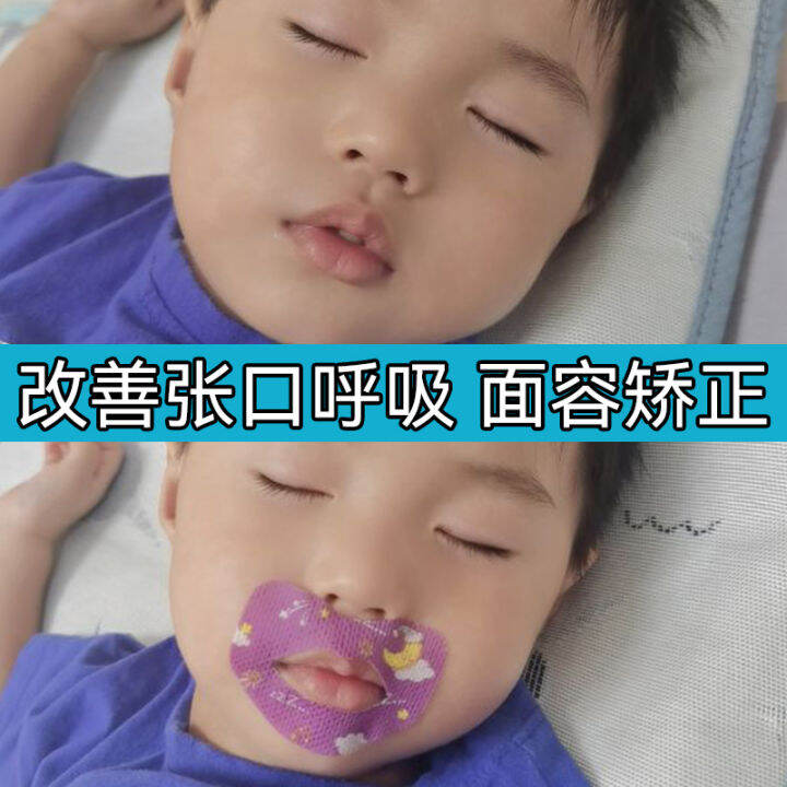 Brace Child Sleeping Open Mouth Breathing Correction Mouth Stickers