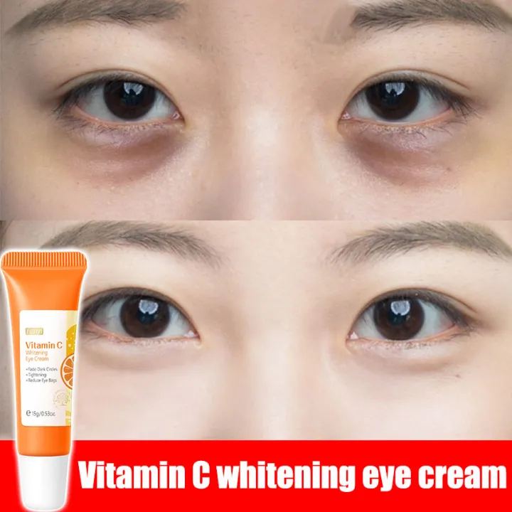 15g Vitamin C Whitening Eye Cream Moisturizing And Brightening Eye Skin