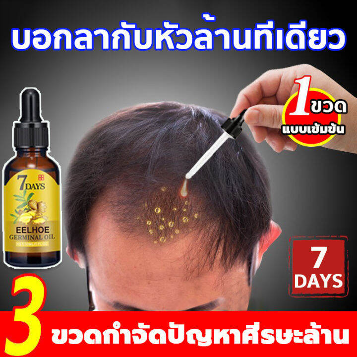 ได้ผลดีมาก】หมดปัญหาผมร่วง Eelhoe น้ำยาปลูกผม 40Ml เร่งการงอกใหม่ ป้องกันไม่ให้ขิงหลุด  รากผมแข็งแรง ดูแลหนังศีรษะ ​ยาปลูกผมของแท้ เซรั่มบำรุงผม เซรั่มปลูกผม  น้ำยาเร่งผมยาว ซรั่มปลูกผม ยาปลูกผมผู้ชาย น้ำยาปลูกผมชาย เร่งผมขึ้นใหม่  สเปรย์ปลูกผม | Lazada.Co.Th