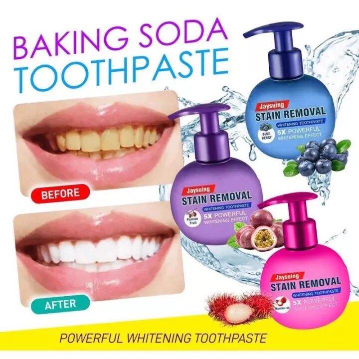 STAIN REMOVAL TOOTHPASTE(သွားဖြူဆေး ) Lazada