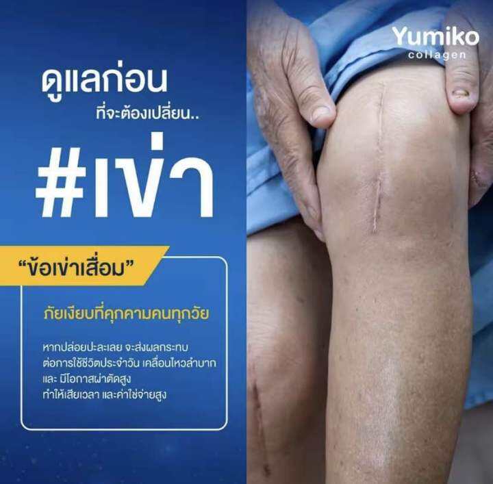 1-แถม-2-ส่งฟรี-yumiko-collagen-ยูมิโกะ-คอลลาเจน-แก้ปวดข้อ-ปวดเข่า-บำรุงกระดูก-ฝ้า-กระ-กระปุก-50-กรัม