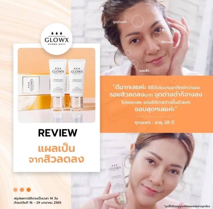 พร้อมส่งglowx-โกรว์เอ็กซ์เจลครีม-บำรุงผิวหน้าชุ่ทชื่น-สว่างใส-ลดฝ้า-กระ-จุดด่างดำ