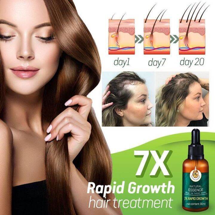 Ginger Hair Growth Essential Oil Rapid Hair Growth Serum Anti Hair Loss 