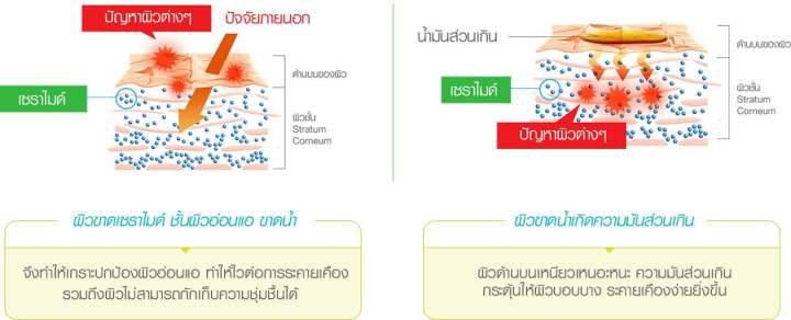 curel-sebum-trouble-care-sebum-care-lotion-150-ml-คิวเรล-ซีบัม-ทรับเบิ้ล-แคร์-ซีบัม-แคร์-โลชั่น