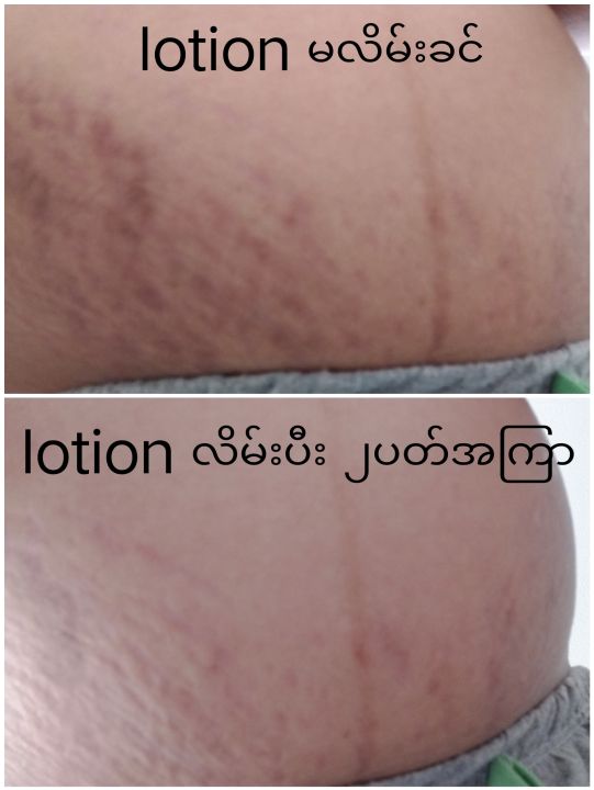 shiroi-ชิโรอิ-กลูต้า-เบอร์รี่-พลัส-วิต-ซี-ไวท์-บอดี้-ครีม-500-กรัม-shiroi-gluta-berry-plus-vit-c-white-body-cream-shiroi