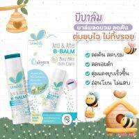 Umbili Anti &amp; After B.Balm บาล์มทาหลังยุงกัด อัมบิลิ แอนติ &amp; อาฟเตอร์ บีบาล์ม 5g