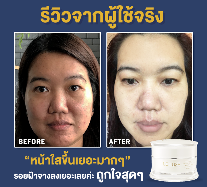 le-luxe-france-absolute-revitalizing-natural-skin-5g-12-ซอง-ครีมมาส์กหน้า-แอ๊บโซลูท-แก้ปัญหา-ฝ้า-กระ-ผิวแห้ง-หน้าโทรม