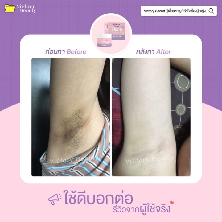 ของแท้-onny-ครีมรักแร้แม่แพท-ครีมทารักแร้ออนนี่-ครีมบำรุงรักแร้-รักแร้ออนนี่-รักแร้ขาวกระจ่างใส-ลดตุ่มหนังไก่