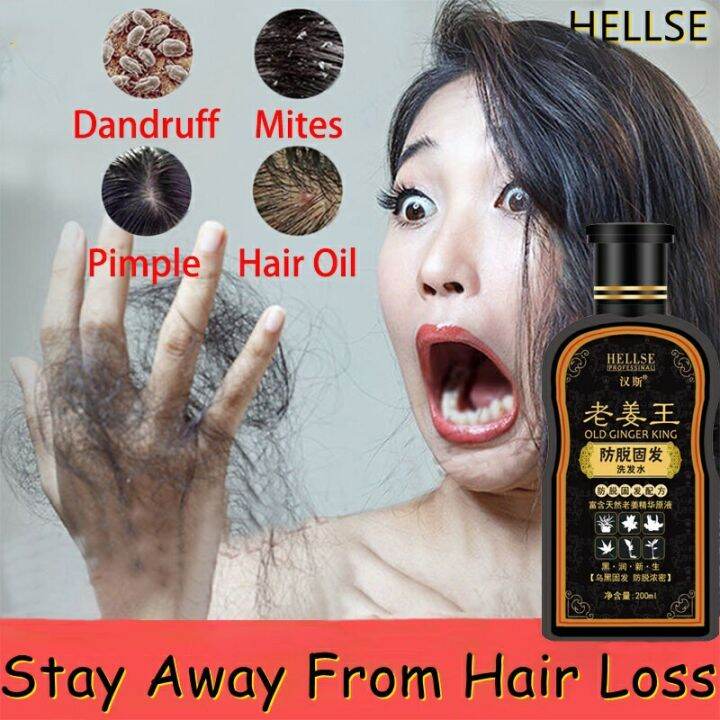 Hair Loss Shampoo 200ml Ginger Hair Fall Control Shampoo Oil Control Shampoo for Severe Dandruff