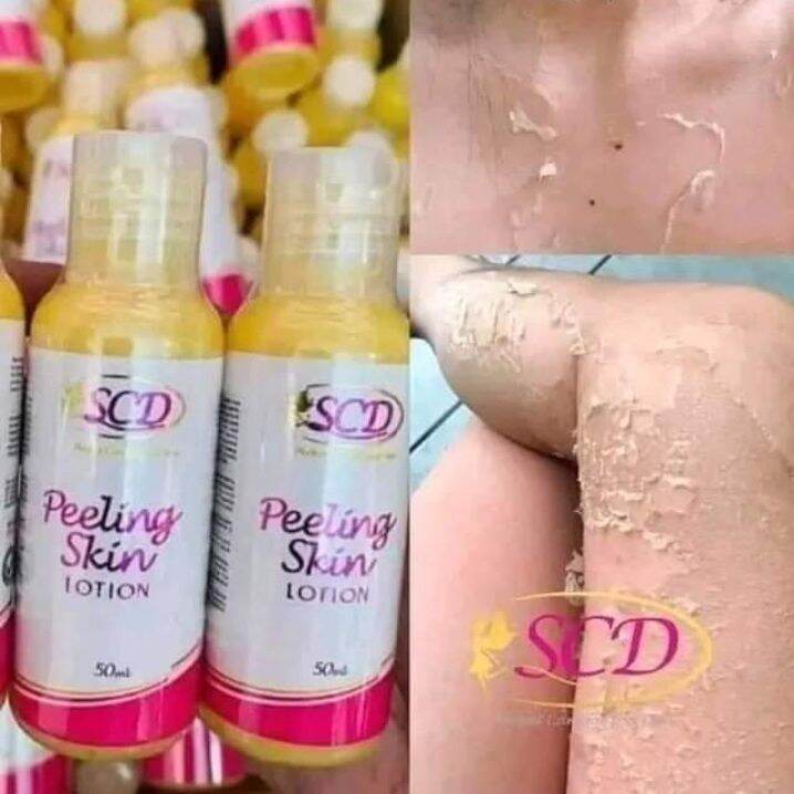 Scd Peeling Lotion Lazada Ph 8314