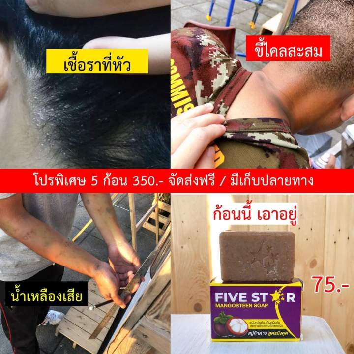 สบู่มังคุด-สบู่ห้าดาว-five-star