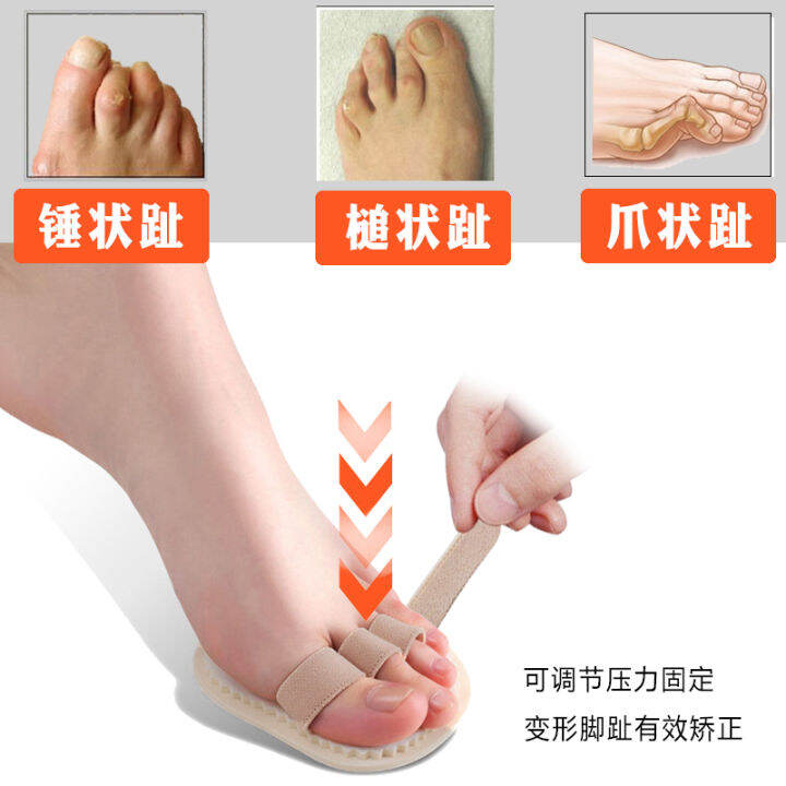 Toe Bending Corrector Claw Toe Hammer Mallet Toe Two Feet Finger Correction Deformation Overlap
