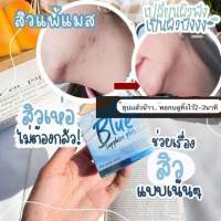 สบู่บลูแซฟไฟร์ สบู่เคลียร์สิว สบู่สิว ลดความมัน Blue Sapphire Plus