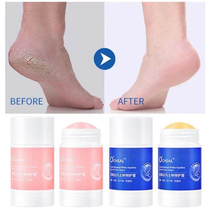 vaseline-anti-drying-crack-foot-cream-hand-cracked-repair-cream-removal