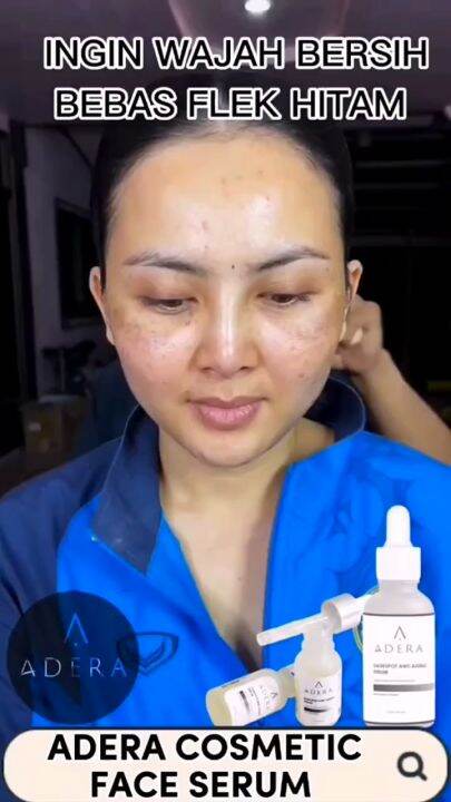 ADERA DARKSPOT SERUM Mengatasi Flek Hitam, Keriput, Dan Bekas Jerawat ...