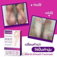 ดร.สมูท dr.smooth ถุงลอกเท้า ส้นเท้าแตก ด้าน หนา ไม่ต้องไปขูด ง่ายๆแค่สวม การันตีด้วยยอดขายอันดับ 1ขนาด 2คู่ /กล่อง