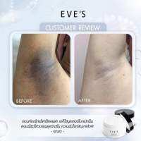 EVES บูสเตอร์บำรุงผิวขาว ลดความหมองคล้ำใต้รักแร้ ขาหนีบ ลดรอยแตกลายอย่างได้ผล