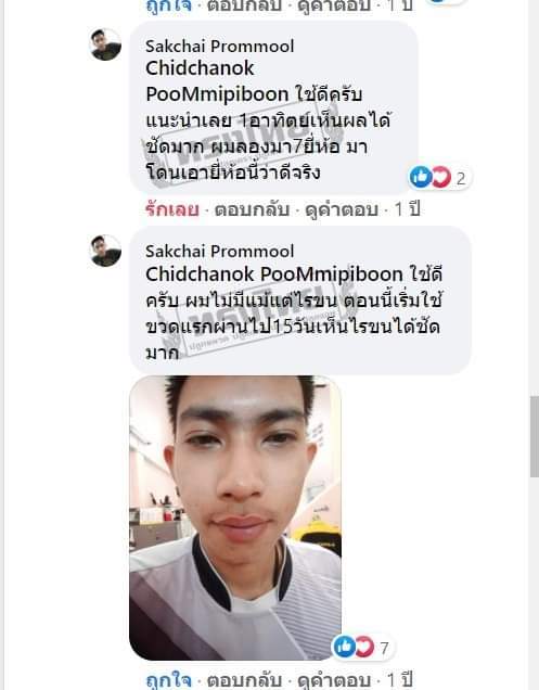 ปลูกหนวด-ปลูกคิ้ว-ปลูกผม-ทรงไทยปลูกผม-เร่งให้หนา-ดกดำขึ้น-พิเศษซื้อ-1-แถม1