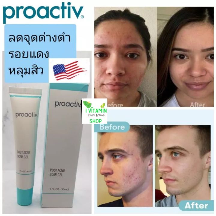 proactiv-post-acne-scar-gel-โปรแอคทีฟ-ครีมลดหลุมสิว-จุดด่างดำ-รอยแดงจากสิว-ขายดีอันดับ1ในอเมริกา-proactive-รอยแผลเป็นสิว