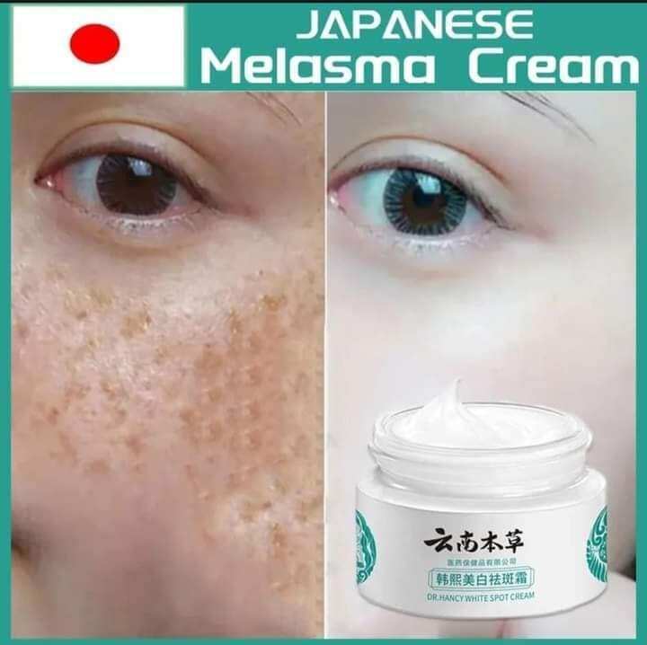 JAPANESE CREAM FOR MELASMA Lazada PH
