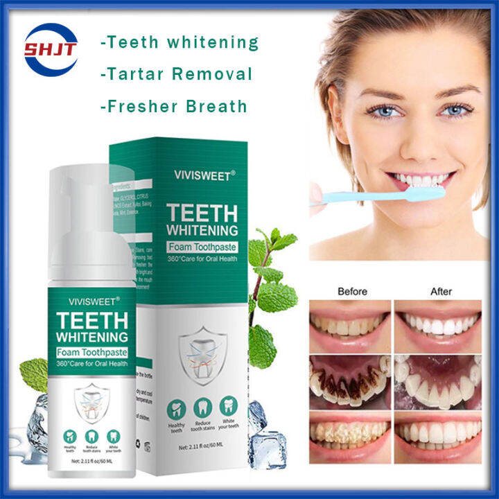 SHJT Teeth whitening cleaner mousse toothpaste tartar removal for teeth ...