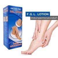 น้ำยาแช่เท้า F.G.L Lotion สำหรับแช่ และ ทำความสะอาดส้นเท้า