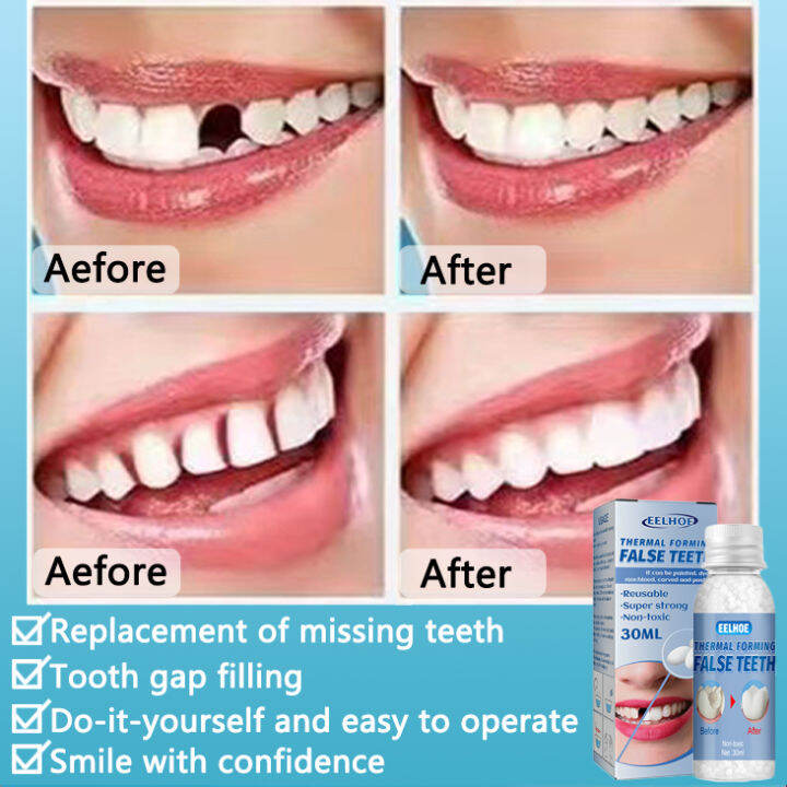 Artificial Temporary Tooth Teeth Denture Adhesive Glue Repair Dental