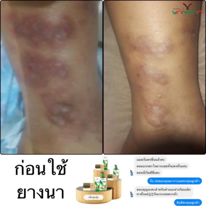 โลชั่นยางนา-โลชั่นน้ำมันมะพร้าวสะกัดเย็น