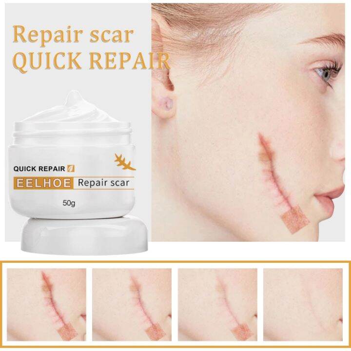 Original EELHOE Scar Removal Cream For Old Scars 50g Remover Cream for
