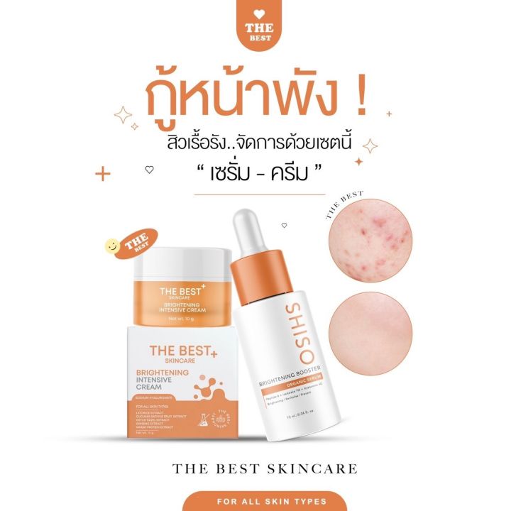 the-best-เซทคู่หูหน้าใสจึ้ง-ลดสิวสุดปัง-เซทขายดี-เซรั่ม-ไนท์ครีม