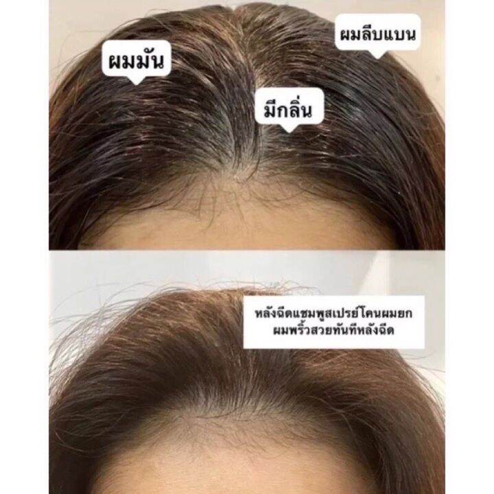 สเปรย์ฉีดผมแห้ง150ml-กำจัดผมมันโดยไม่ต้องล้างออก-สเปรย์แก้ผมมันใน15-วินาที