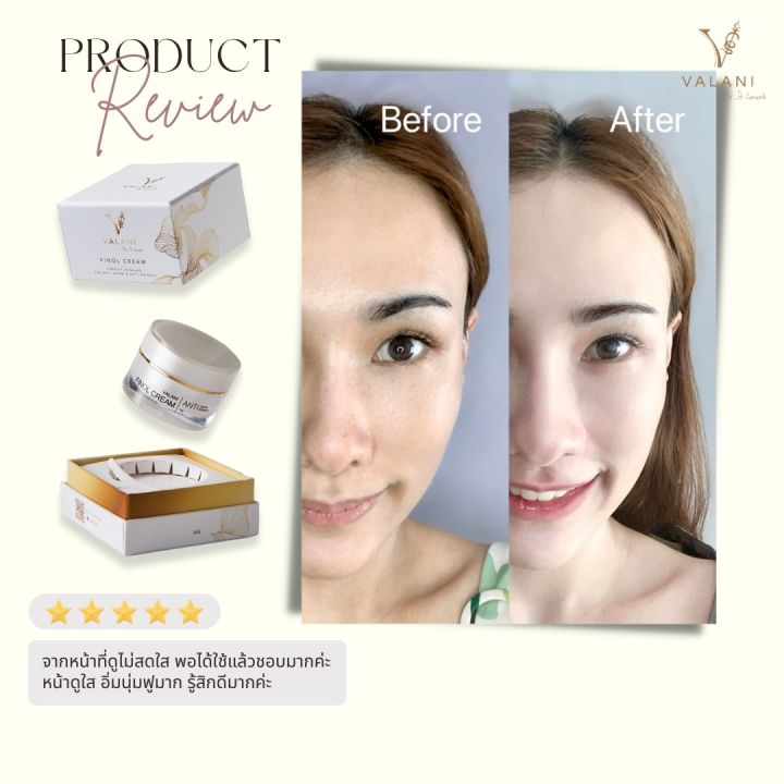 valani-finol-cream-anti-aging-anti-wrinkle-ครีมย้อนวัยผิว-อ่อนเยาว์-ด้วยสารสกัดพรีเมี่ยม5ตัวจากฝรั่งเศส