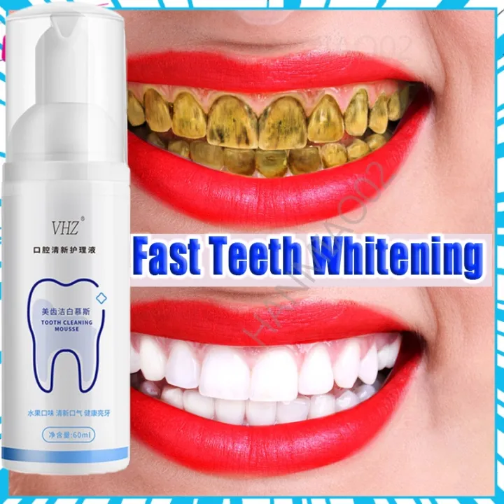 【Ready Stock】Teeth Whitening Plaque Remover Teeth Cleansing Removes ...