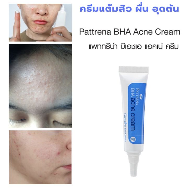 ครีมแต้มสิวอุดตัน-สิวเสี้ยน-กิฟฟารีน-แพทริน่า-bha-aha-แอคเน่-giffarine-patrena-acne-8g