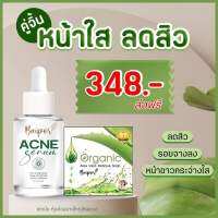 หน้าใส ลดสิว