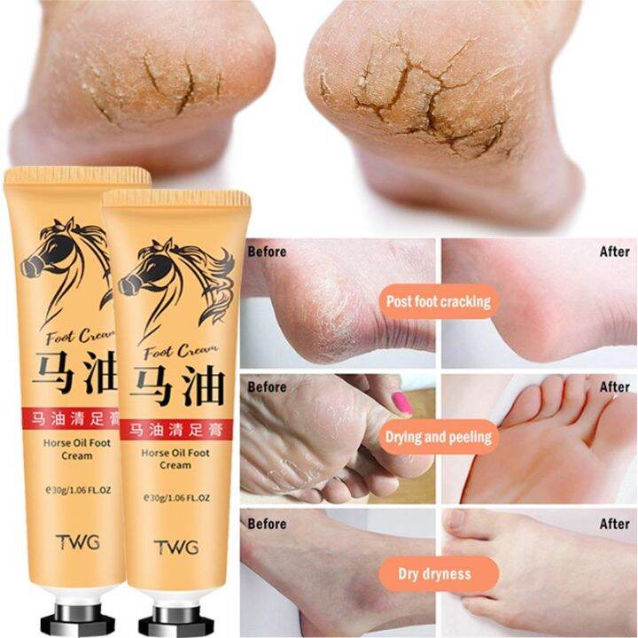 Monfince Foot Cream Horse Oil ,Best Callus Remover for Feet, Knees& Elbows,Natural Moisturizes Nourishes Softens Dry, Rough, Cracked, Dead Skin , 30g