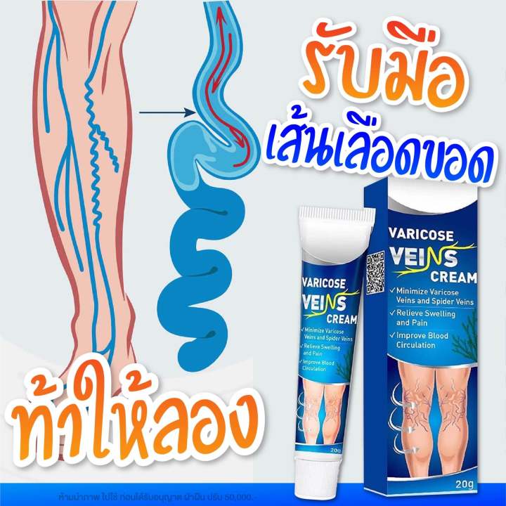 ครีมทาเส้นเลือดขอด-ของแท้-2-แถม-2-550-บาท-พร้อมส่ง-ในไทย-ขนาด20-กรัม