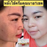 #ครีมคุณนาย หน้าขาวใสไร้สิวฝ้าเห็นผลพายใน7วันเซต4ชิ้นบำรุงขั้นสุด มีของแถมทุกออเดอร์