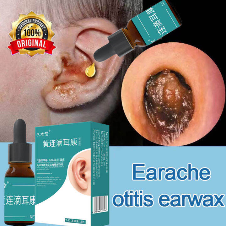 Ear drops for otitis media ear wax cleanser 15ml Relieving for Ear Pain