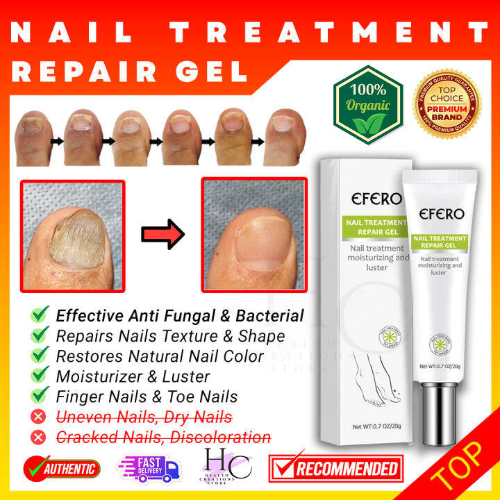EFERO Nail Treatment Repair Gel Nail Treatment Fungal Nail Fungus Treatment Serum Fungal Anti