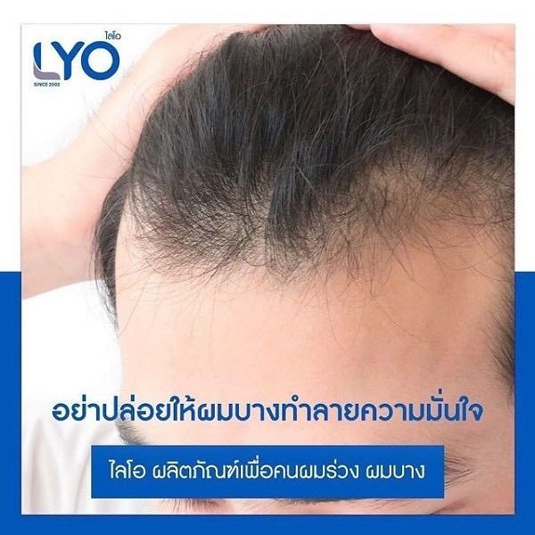 lyo-shampoo-ไลโอ-แชมพู-200ml-ลดผมขาดหลุดล่วง