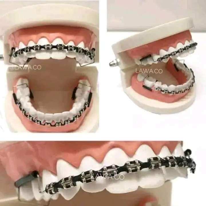 -Chain Up&Down- | Lazada PH