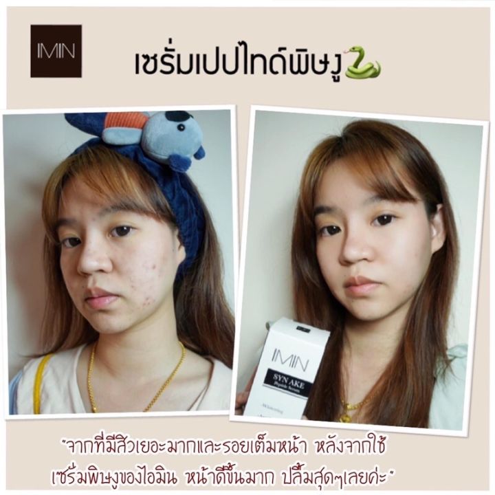 ขายเท-ไอมิน-เซรั่มเปปไทด์-พิษงู-syn-ake-peptide-serum-เห็นผลในขวดแรก